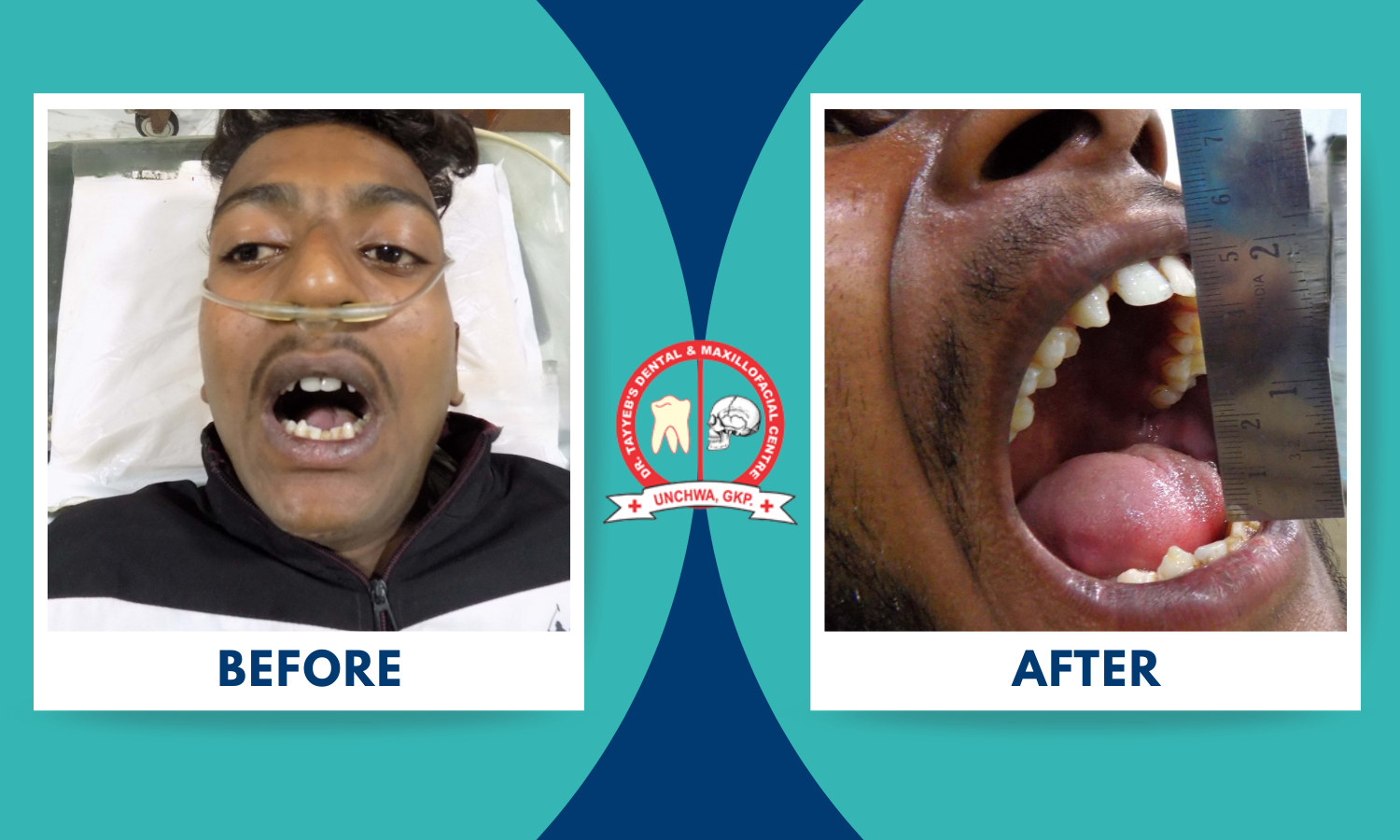tmj processor at dr tayyeb clinic